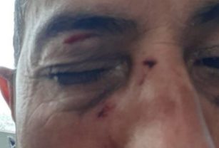 golpeado por pedir el uso del barbijo
