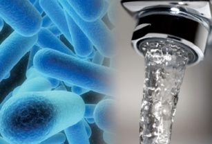 legionella