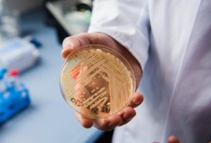 candida auris