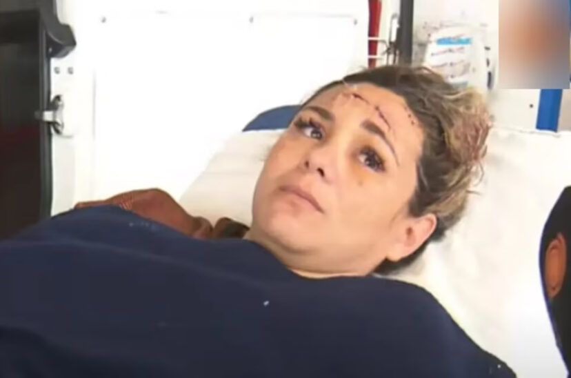 Gisel Vaca Cabeza disparo