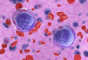leucemia