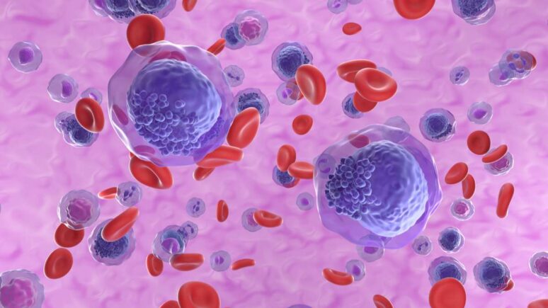 leucemia