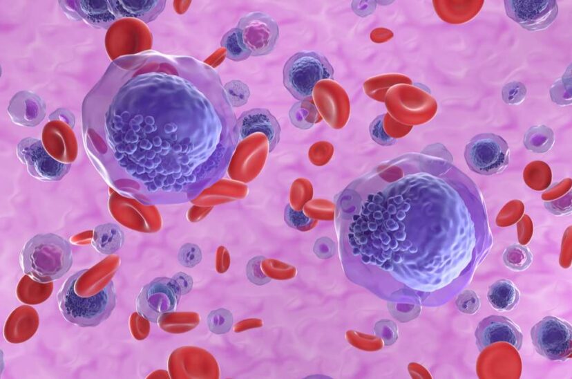 leucemia