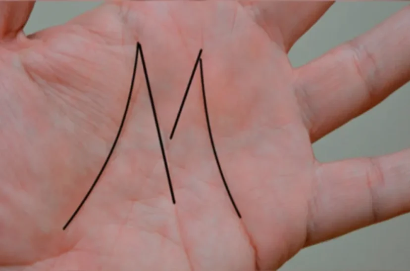 mano