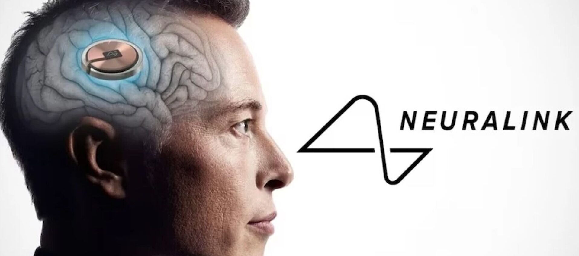 neuralink