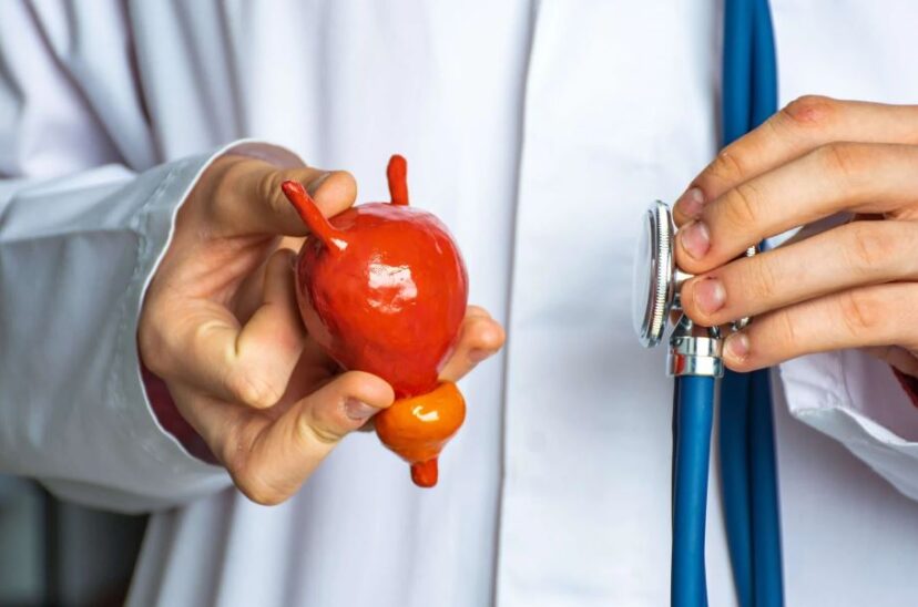 cáncer de próstata