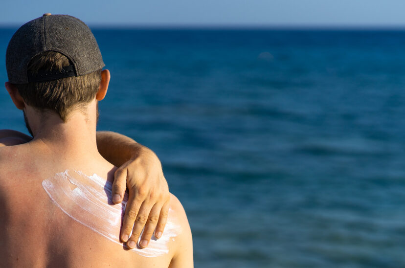 Hombre poniéndose protector solar - cáncer de piel