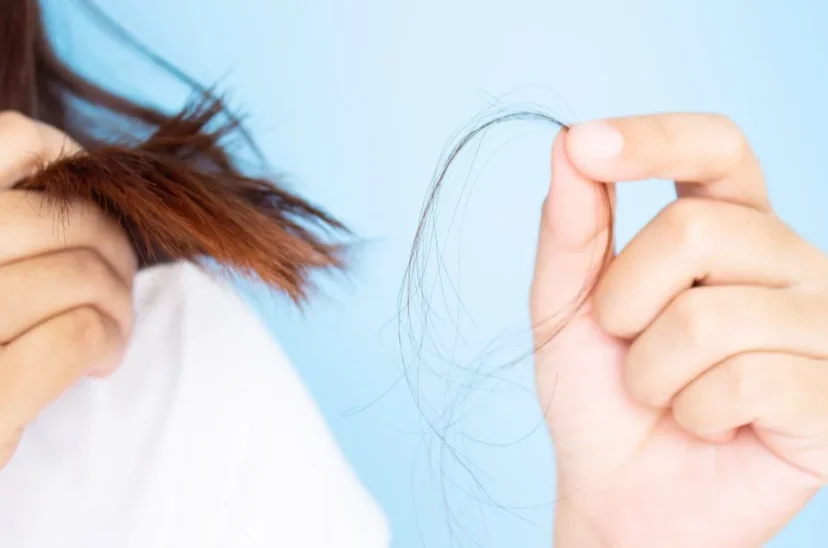 pelo