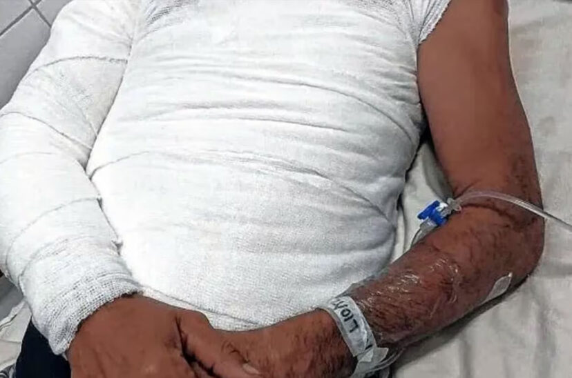 prendio fuego a su hermano por mayonesa