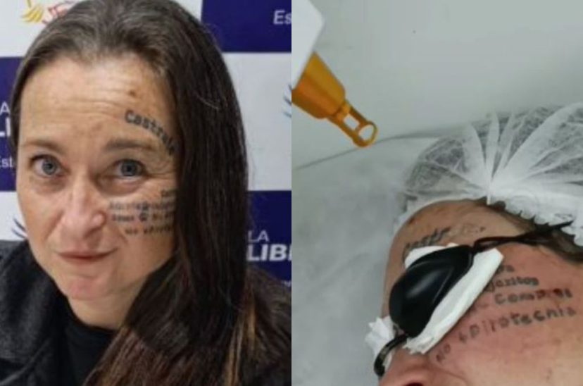 castrate concejal la libertad avanza tatuaje