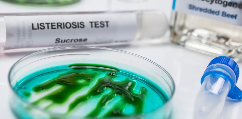 queso criollo listeroris